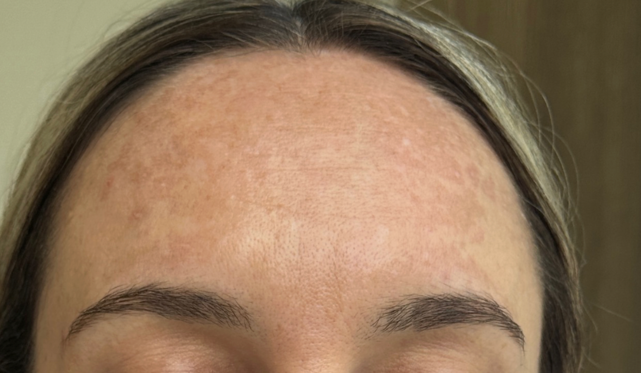 Image de diapositive