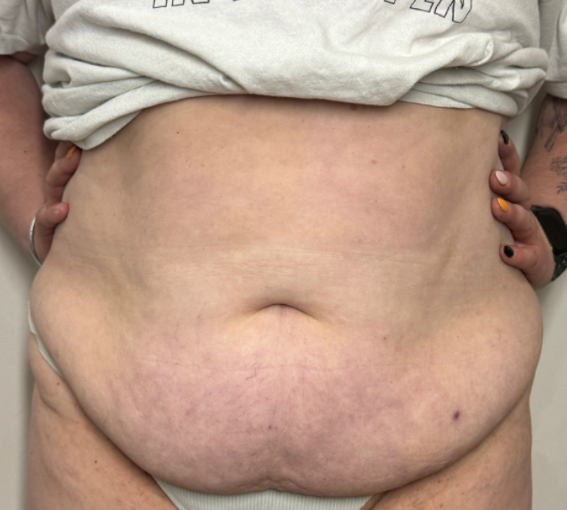 Image de diapositive