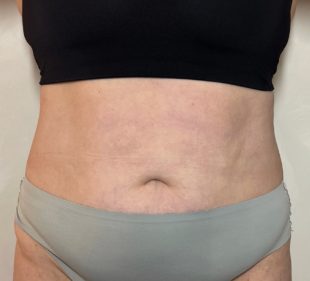 Image de diapositive