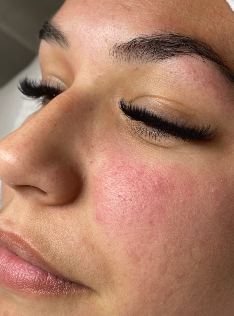 Image de diapositive