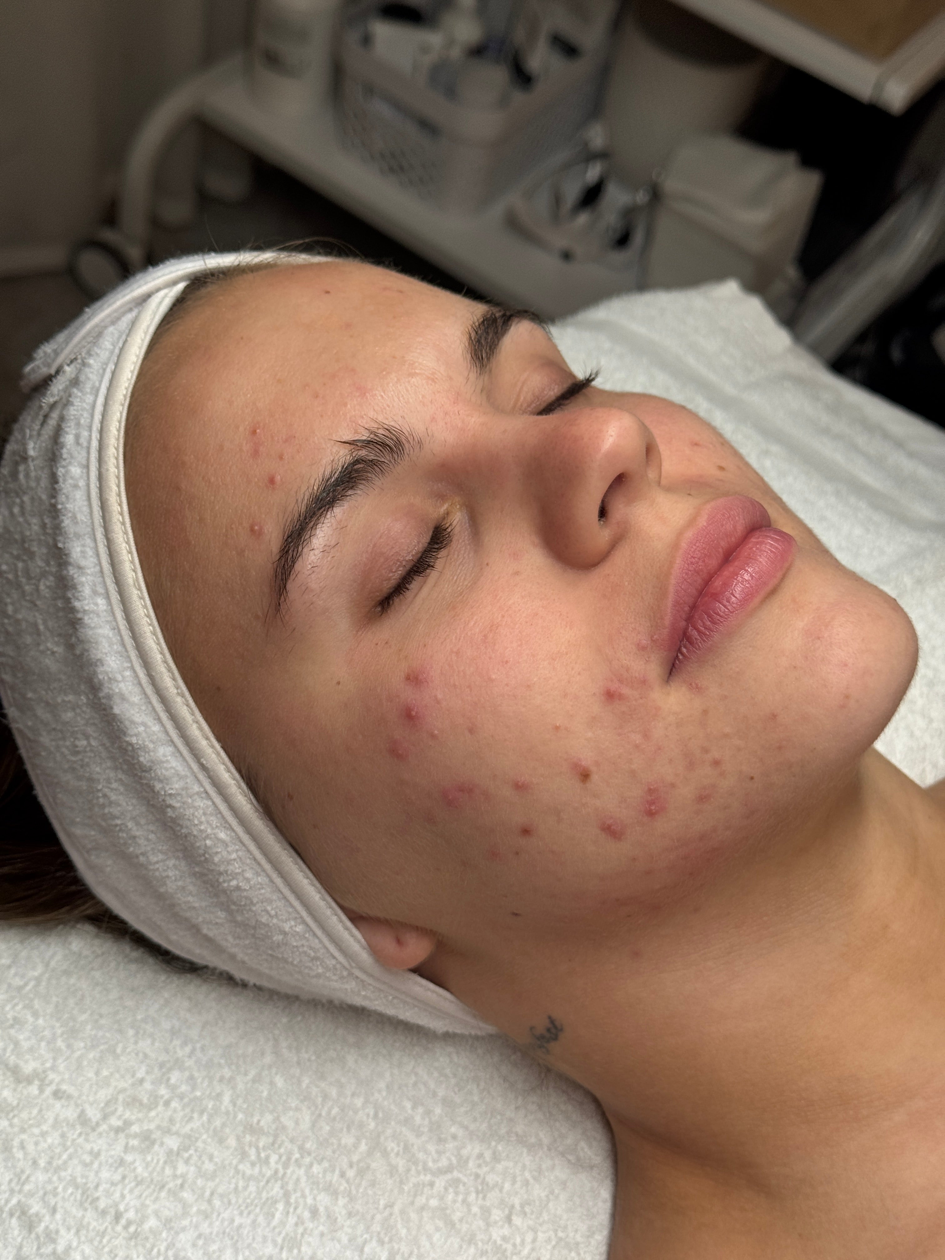 Image de diapositive