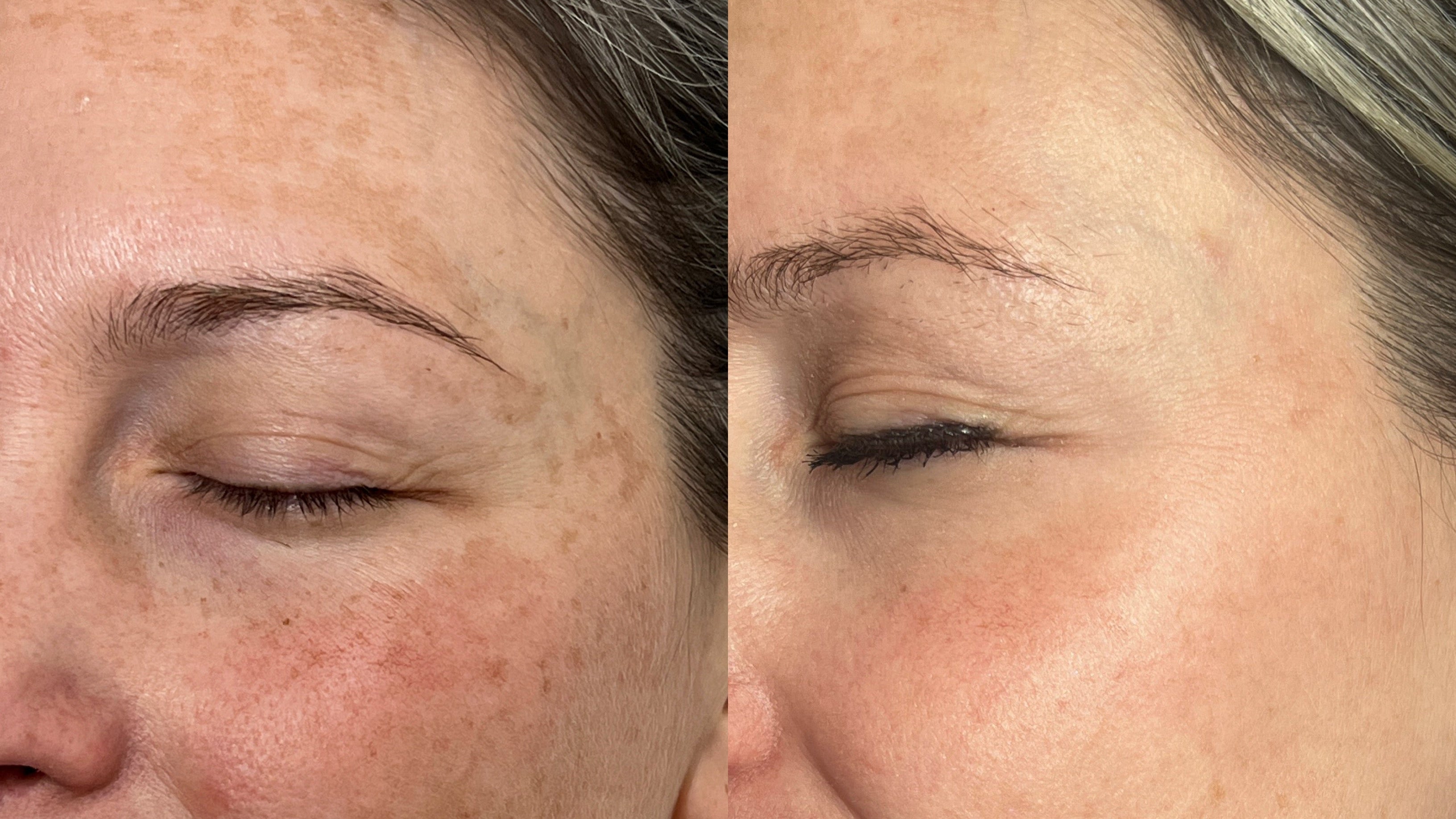 Image de diapositive